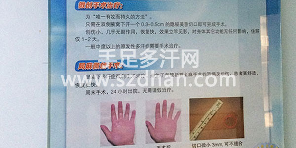 多汗症入院