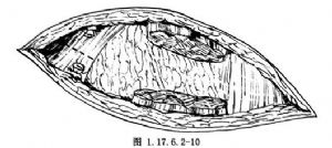 交感神经