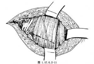 交感神经