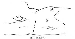 交感神经