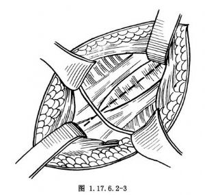 交感神经